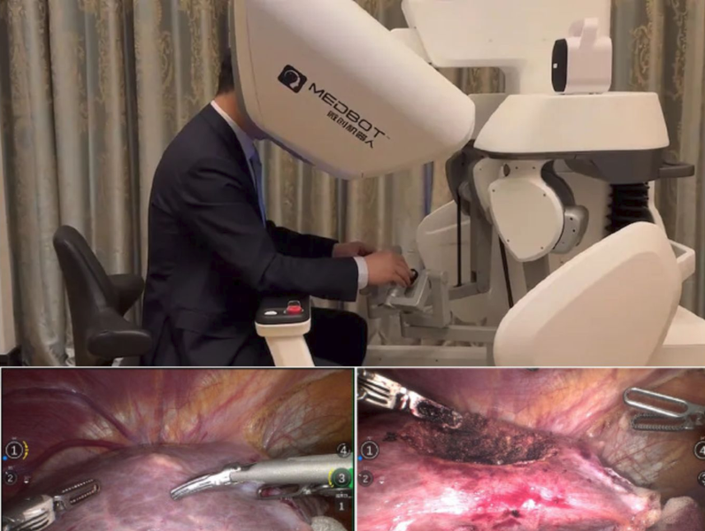 China Performs First Robotic Surgery via Satellite Over a Distance of 5,000 Kilometers