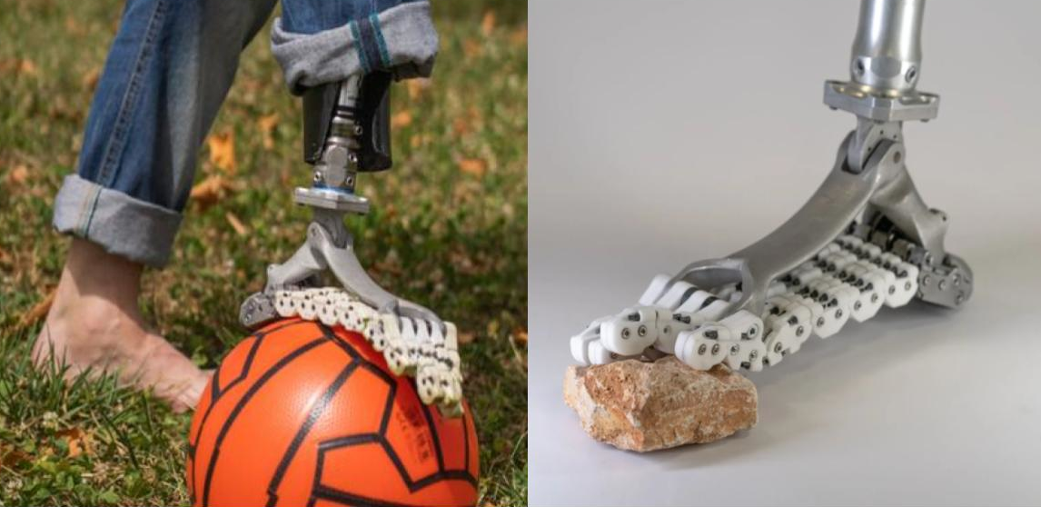 An Innovative Prosthetic Foot: SoftFoot Pro Mimics Natural Foot Movement